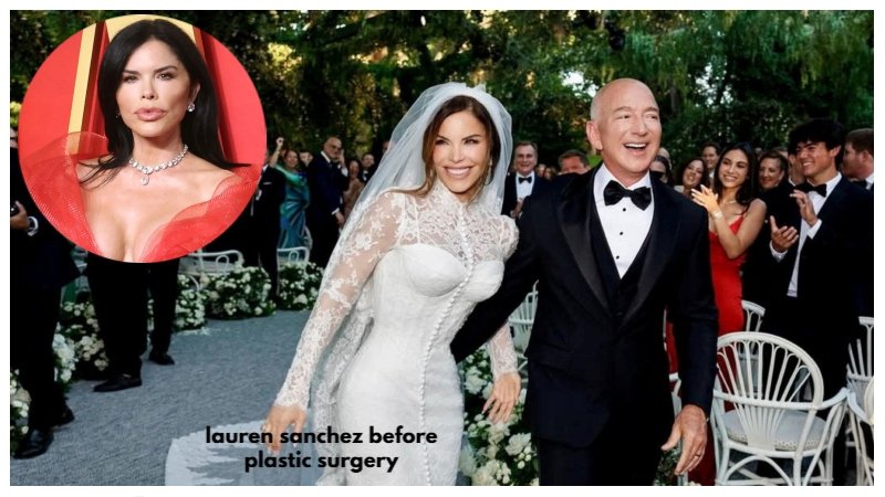 Lauren Sanchez Before Plastic Surgery: A Complete Look at Her Transformation